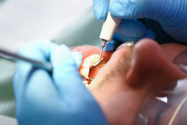 Best Emergency Dentist for Knocked-Out Tooth in Bellerose, NY