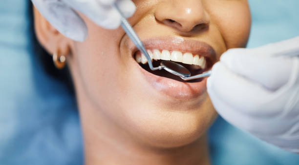 Best Broken or Cracked Tooth Emergency Dentist in Bellerose, NY